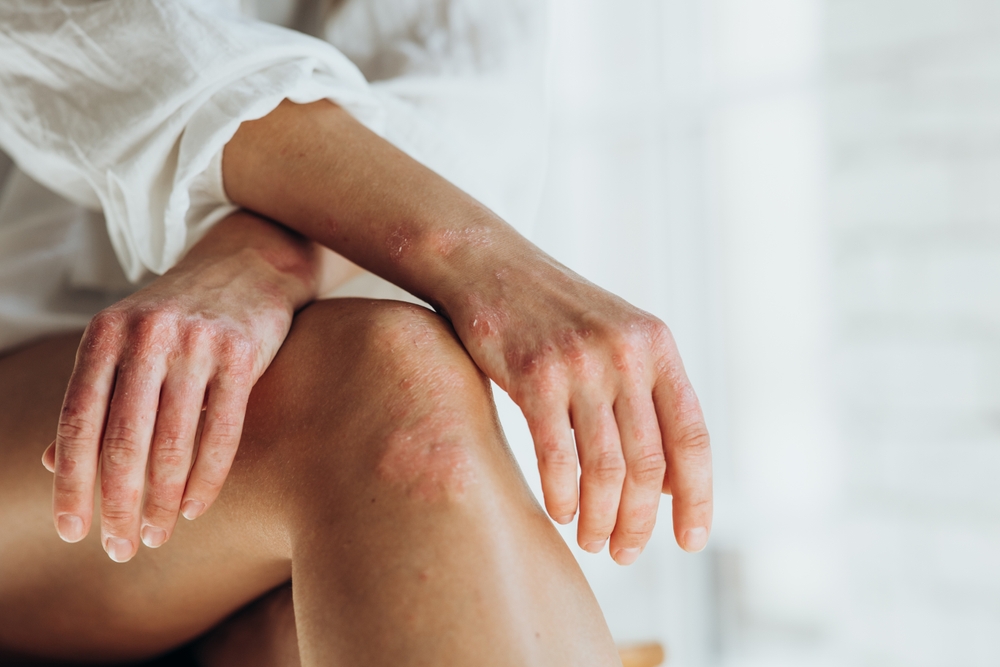 Person scratching irritated skin on their forearm from an autoimmune condition